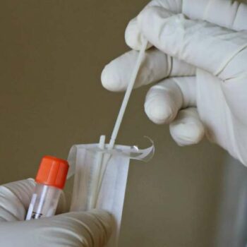 Ein PCR Test der für die Durchführung eines Tests vorbereitet wird.